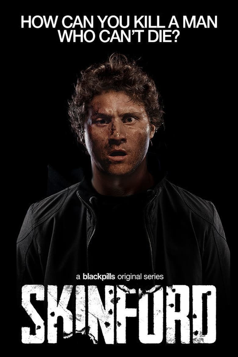 مسلسل Skinford
