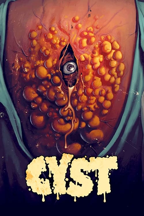 فيلم Cyst